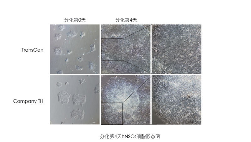 喜訊：全式金獲一項發(fā)明專利授權(quán)--“一種用于人神經(jīng)系統(tǒng)細胞培養(yǎng)和人多能性干細胞向神經(jīng)系統(tǒng)細胞分化的營養(yǎng)添加劑”
